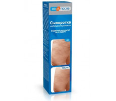 ДО И ПОСЛЕ СЫВОРОТКА А/ЦЕЛЛЮЛИТ. 130МЛ. /ТВИНС ТЭК/