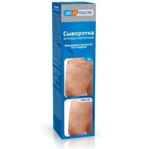 ДО И ПОСЛЕ СЫВОРОТКА А/ЦЕЛЛЮЛИТ. 130МЛ. /ТВИНС ТЭК/ ДО И ПОСЛЕ СЫВОРОТКА А/ЦЕЛЛЮЛИТ. 130МЛ. /ТВИНС ТЭК/