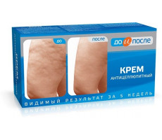 ДО И ПОСЛЕ КРЕМ А/ЦЕЛЛЮЛИТ. 100МЛ. /ТВИНС ТЭК/