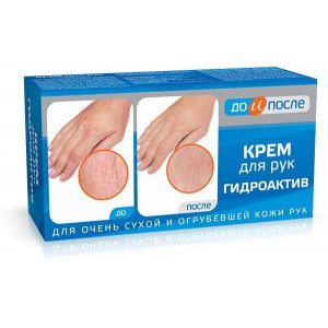 ДО И ПОСЛЕ КРЕМ Д/РУК Д/СУХОЙ И ОГРУБ. КОЖИ ГИДРОАКТИВ 100МЛ. /ТВИНС ТЭК/ ДО И ПОСЛЕ КРЕМ Д/РУК Д/СУХОЙ И ОГРУБ. КОЖИ ГИДРОАКТИВ 100МЛ. /ТВИНС ТЭК/